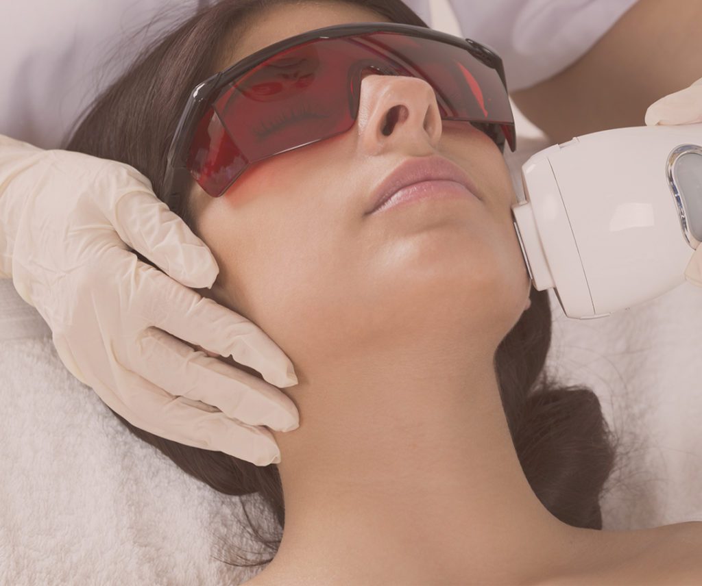 Ultimate Guide To Laser Hair Removal